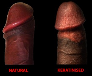 natural-keratinised